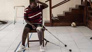 Amid escalating violence in Eastern Congo, demand for prosthetics soars