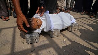 400 people in Gaza have died of malnutrition since start of the year, WHO says